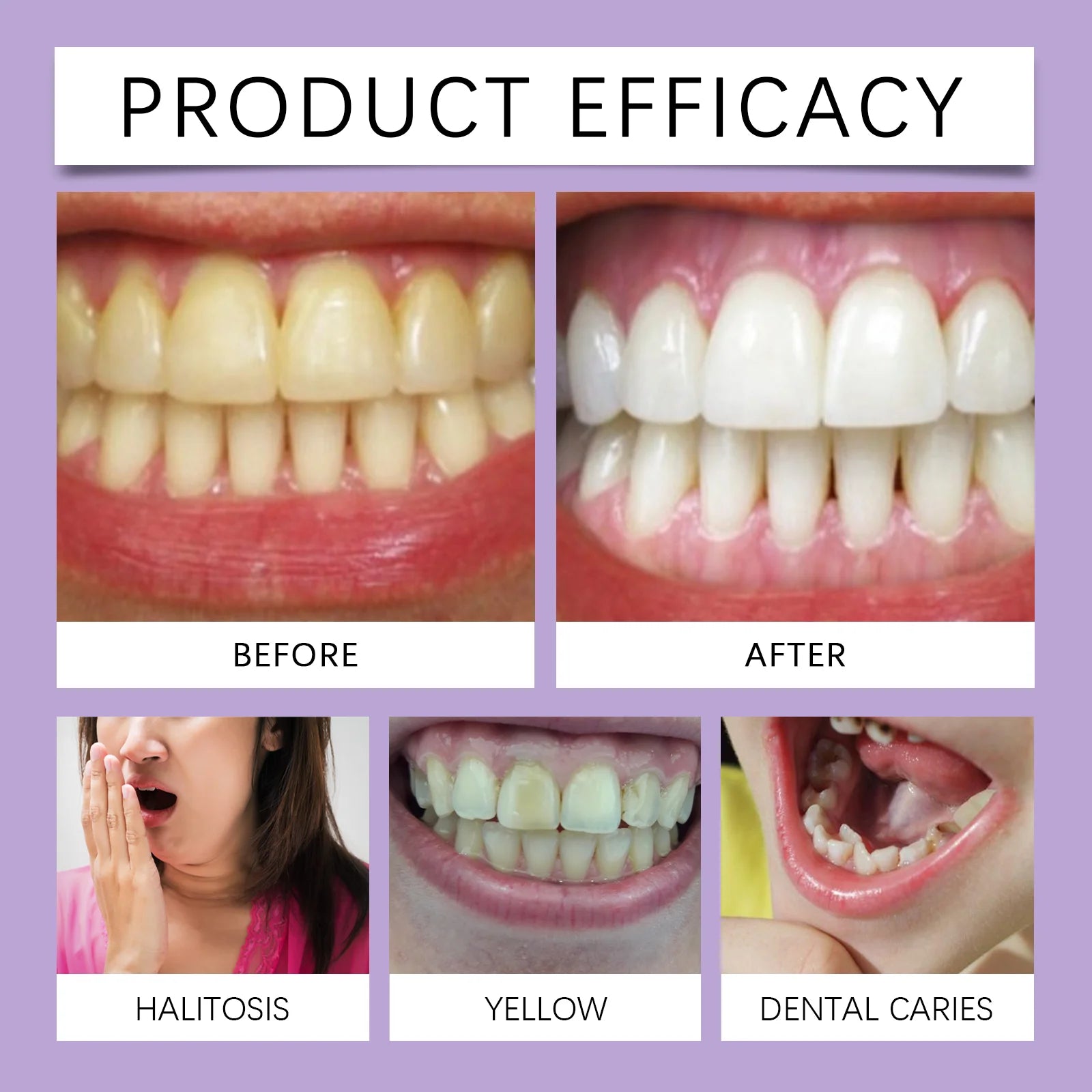 Oralhoe Mint Purple Gum Care Gel Pen Deep Cleaning Nourishing Strengthening Relief Discomfort Non-irritating Gum Health Care Gel
