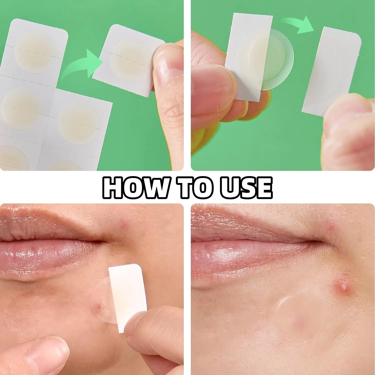Hydrocolloid Acne Patch