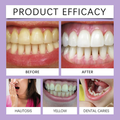 Oralhoe Mint Purple Gum Care Gel Pen Deep Cleaning Nourishing Strengthening Relief Discomfort Non-irritating Gum Health Care Gel