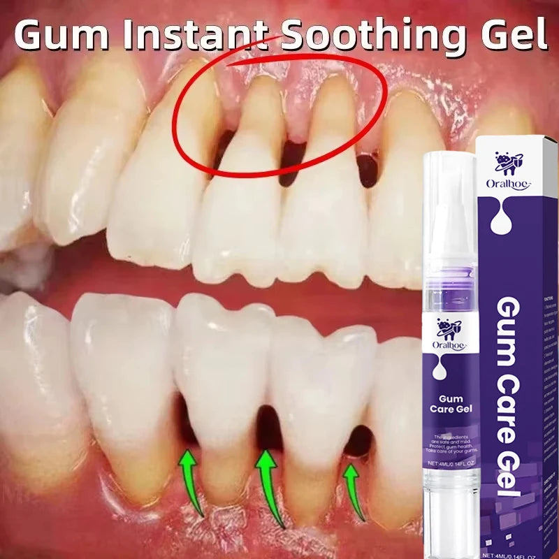 Repair Damaged Gums Gel Serum Rapid Relieve Sore Tooth Allergy Dental Caries Tooth Cleaning Deep Cleaning Teeth Stain Toothpaste