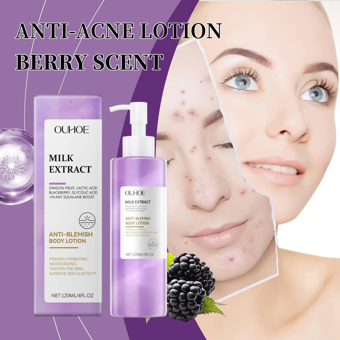 Berry Scented Blemish Lotion Care Facial Moisturizer Reduce Breakouts &amp; Tighten Skin Non-Comedogenic Hydrator Clear Glowing