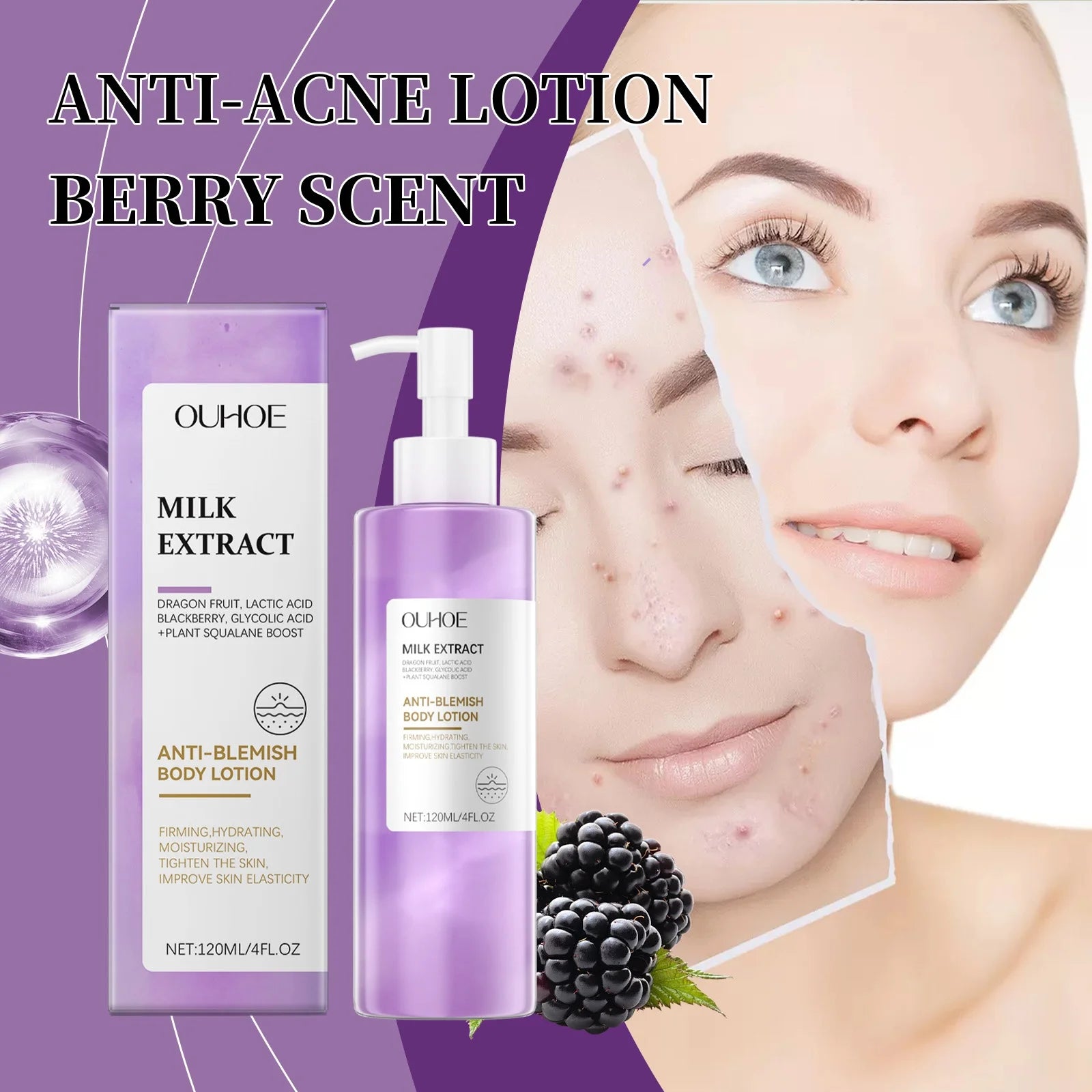 Berry Scented Blemish Lotion Care Facial Moisturizer Reduce Breakouts &amp; Tighten Skin Non-Comedogenic Hydrator Clear Glowing