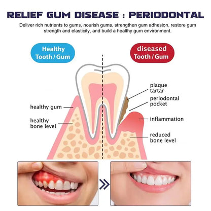 Repair Damaged Gums Gel Serum Rapid Relieve Sore Tooth Allergy Dental Caries Tooth Cleaning Deep Cleaning Teeth Stain Toothpaste
