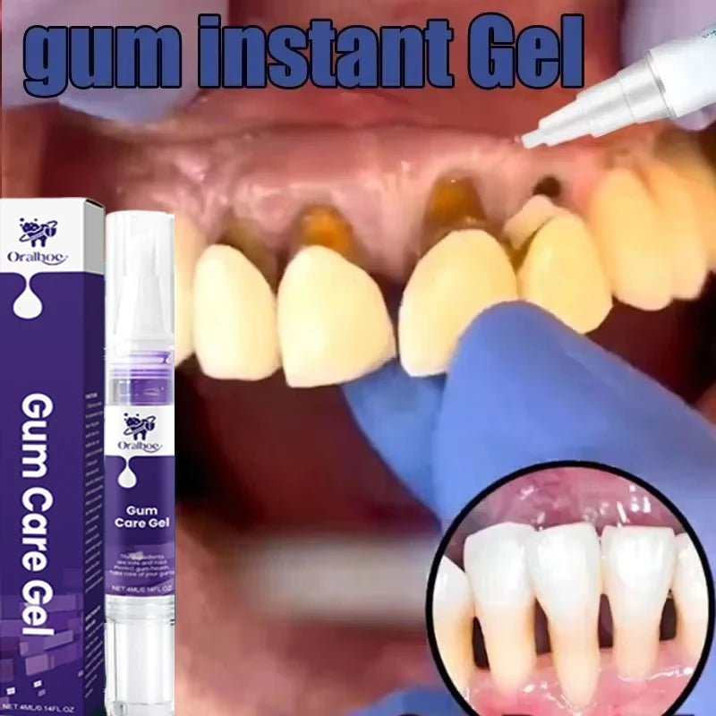 Repair Damaged Gums Gel Serum Rapid Relieve Sore Tooth Allergy Dental Caries Tooth Cleaning Deep Cleaning Teeth Stain Toothpaste
