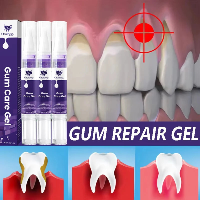 Repair Damaged Gums Gel Serum Rapid Relieve Sore Tooth Allergy Dental Caries Tooth Cleaning Deep Cleaning Teeth Stain Toothpaste