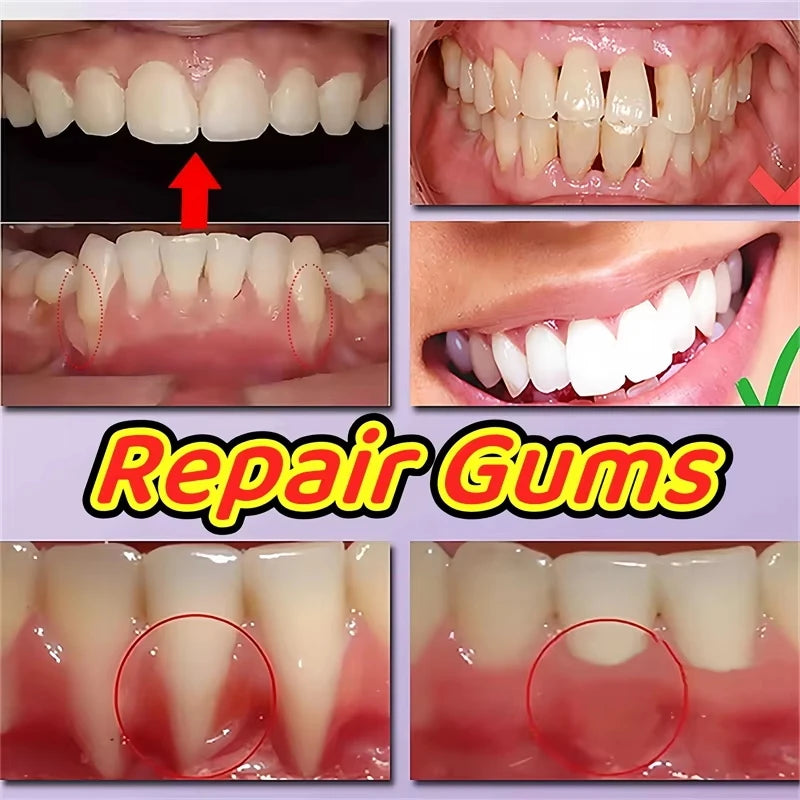 Repair Damaged Gums Gel Serum Rapid Relieve Sore Tooth Allergy Dental Caries Tooth Cleaning Deep Cleaning Teeth Stain Toothpaste