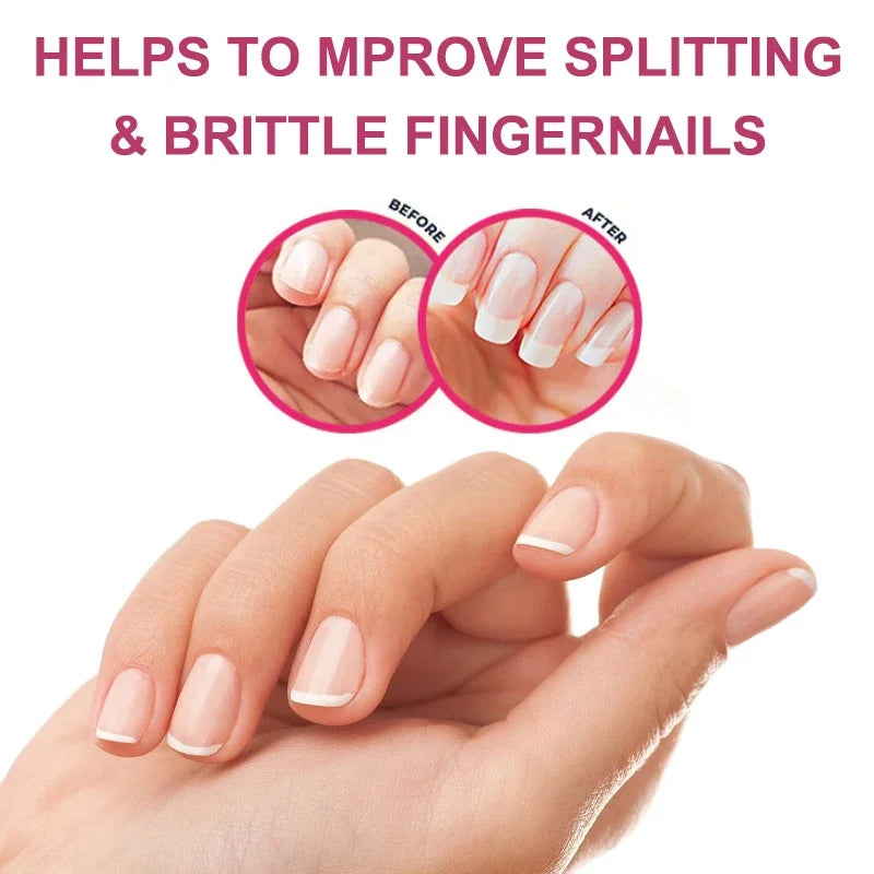 Hair, Skin &amp; Nails Gummies | Hair Vitamins for Men and Women | Biotin SupplementsSupplements