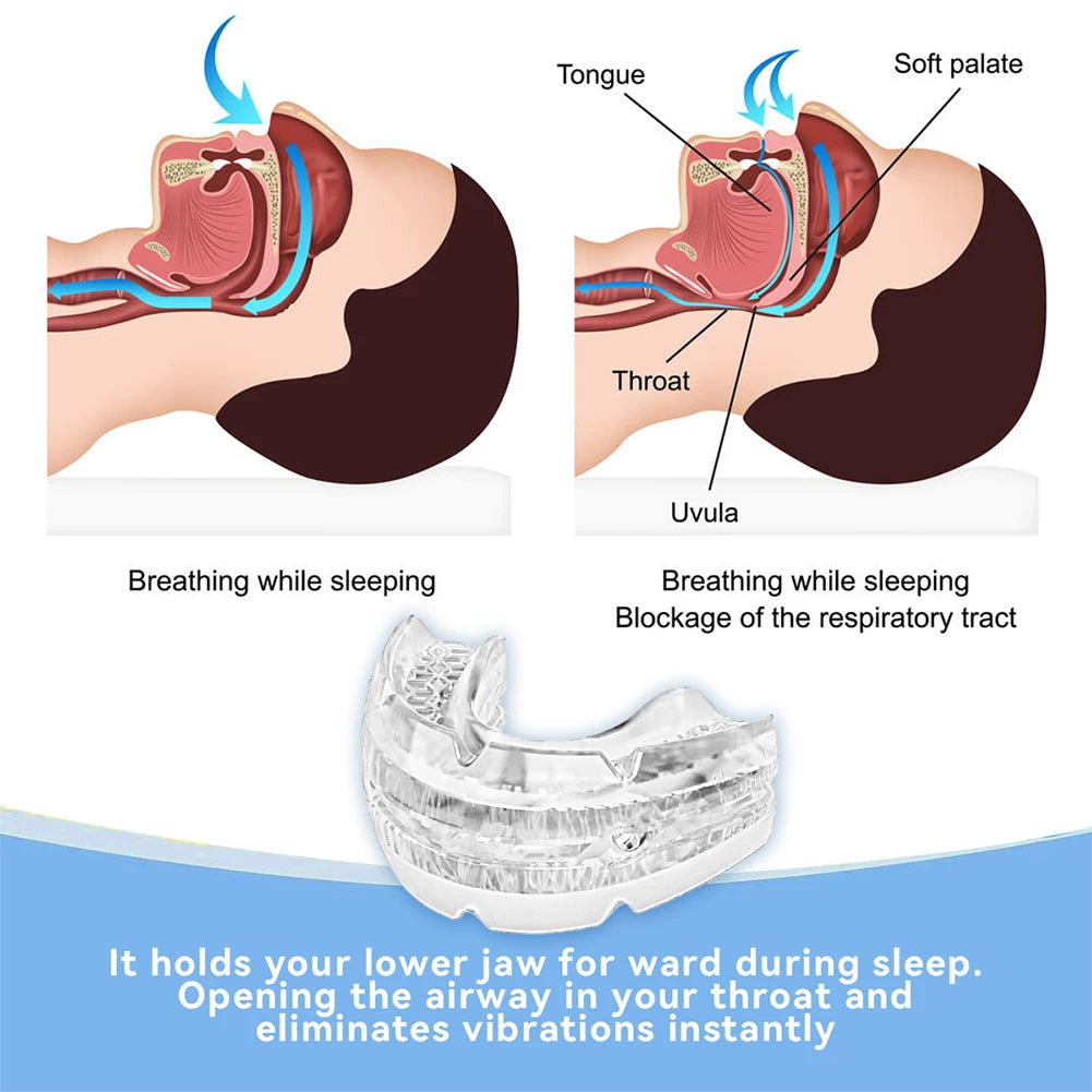 Anti Snoring Mouth Guard Improve Sleeping Adjustable Snoring Mouth Guard Anti-Snoring Mouthpiece Sleeping Devices for Men Women