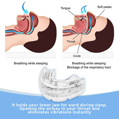 Anti Snoring Mouth Guard Improve Sleeping Adjustable Snoring Mouth Guard Anti-Snoring Mouthpiece Sleeping Devices for Men Women